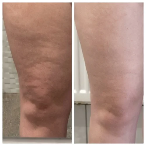 MaxSculpt Pro™ – Standesnė, Elastingesnė Oda photo review