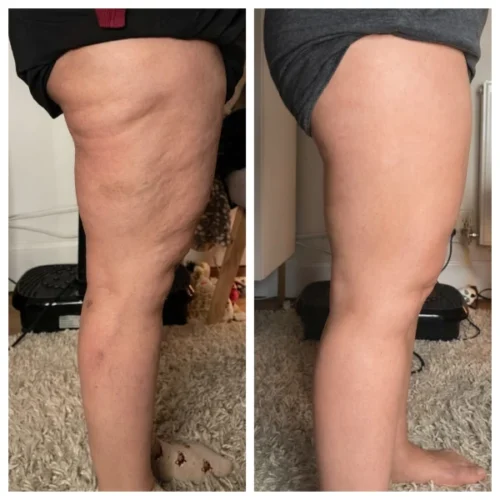 MaxSculpt Pro™ – Standesnė, Elastingesnė Oda photo review