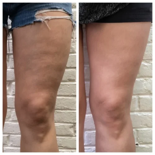 MaxSculpt Pro™ – Standesnė, Elastingesnė Oda photo review