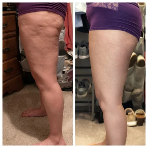 MaxSculpt Pro™ – Standesnė, Elastingesnė Oda photo review